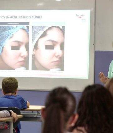 Más de 4000 alumnos de ESO y bachillerato se forman sobre el impacto que causa el acné en la adolescencia