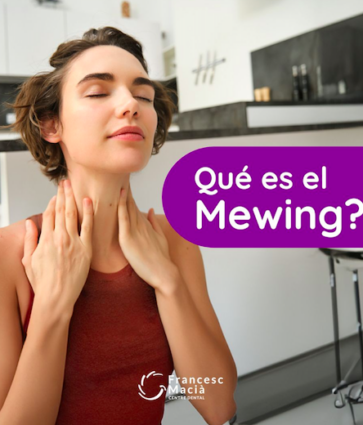 El Centre Dental Francesc Macià explica los secretos del movimiento Mewing 