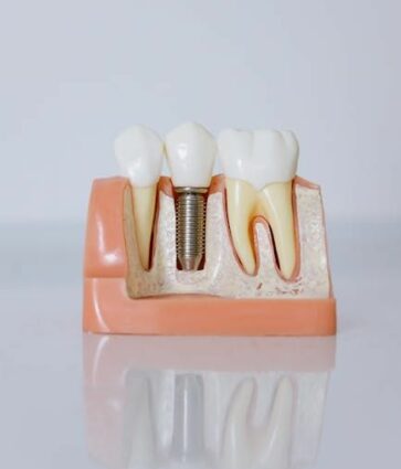 Dr. Javier Ortiz de Urbina: «El éxito de un implante dental depende en gran medida de la experiencia del profesional»