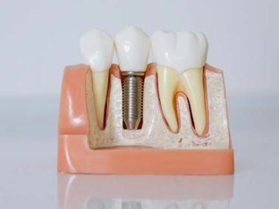 Dr. Javier Ortiz de Urbina: «El éxito de un implante dental depende en gran medida de la experiencia del profesional»