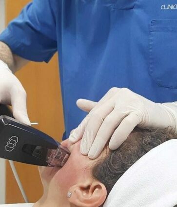 Clínica Fernández incorpora el tratamiento Morpheus8: tecnología mínimamente invasiva para rejuvenecimiento facial y corporal