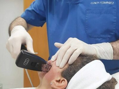 Clínica Fernández incorpora el tratamiento Morpheus8: tecnología mínimamente invasiva para rejuvenecimiento facial y corporal
