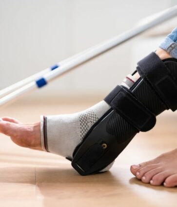 Los esguinces de tobillo mal recuperados pueden provocar inestabilidad y desgaste articular 