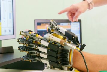 «La neurorrehabilitación permite, en momentos concretos de la enfermedad del Parkinson, mejorar limitaciones motoras, de coordinación o dolor, lo que se traduce en meses o años de vida con mayor calidad», Dr. Alejandro Durán